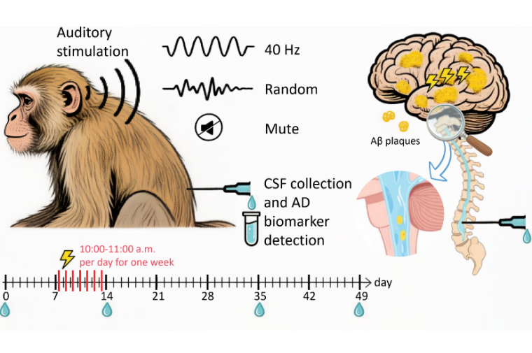 40-Hz Auditory Stimulation Shows Long-Term Efficacy in Aged Monkeys, Offering Potential for Non-Invasive Alzheimer's Therapy